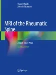 MRI of the Rheumatic Spine Miniatura