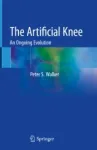 The Artificial Knee Miniatura