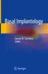 Basal Implantology Miniatura