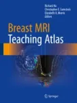 Breast MRI Teaching Atlas Miniatura