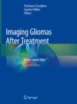 Imaging Gliomas After Treatment Miniatura